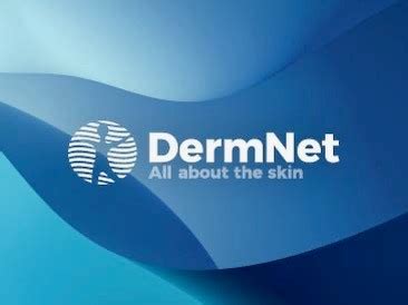 DermNet® .